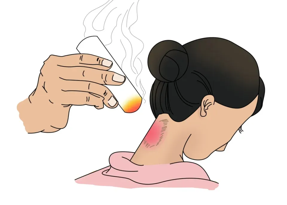 What not to do after moxibustion?